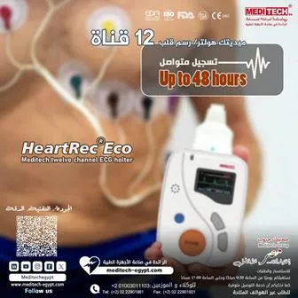 ECG  Holter/ 12قناه / مراقبة مستمرة للقلب / تسجيل لمدة 48 ساعة